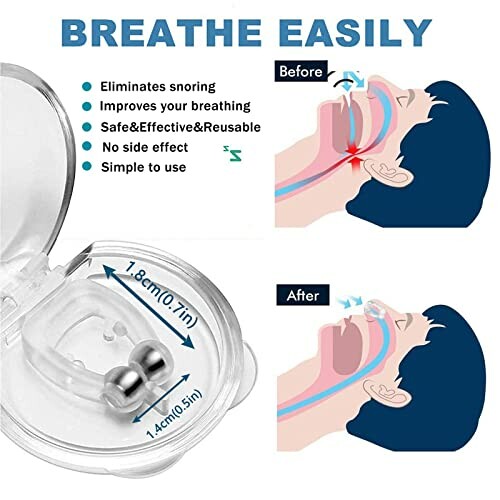 Diagram of an anti-snoring nose clip with before and after illustration.